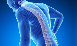 Kemik erimesi olarak bilinen osteoporoz nedir ve belirtileri nelerdir?