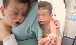 Kan Donduran Olay! 2 Yaşındaki Bebek Dövülerek Hastanelik Oldu