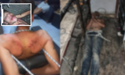 Dişleri Kırıldı, Böcek Yedirildi! 3 Günlük Eziyetin Cezası Belli Oldu!