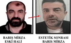 Film Gibi Olay! Estetikle Kimliğini Gizledi 7 Yıl Sonra Yakalandı