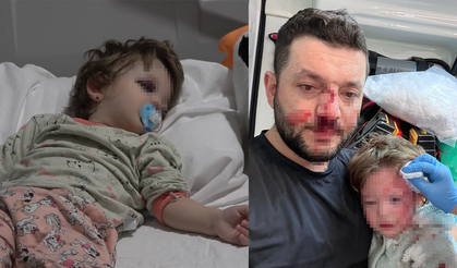 Komşular Arasında Çıkan Kavgada Bebeğe Bile Saldırdılar!