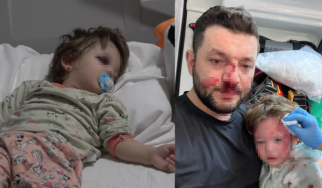 Komşular Arasında Çıkan Kavgada Bebeğe Bile Saldırdılar!