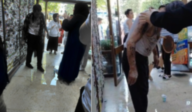 Lavaboyu Açmak İçin Dökülen Kimyasalın Patlaması Sonucu 2 Kişi Yaralandı!