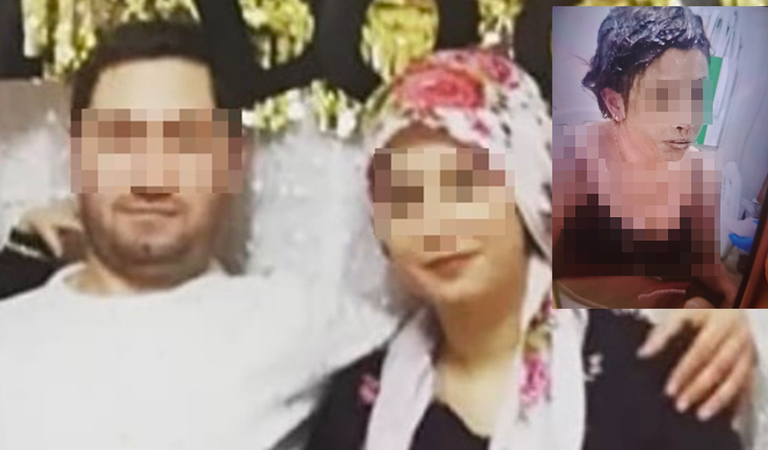 Kan Donduran Saldırı Kadını Kezzapla Yaraladı