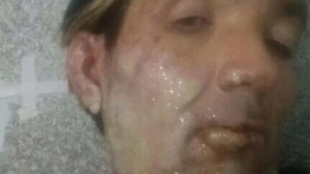 Üzerine Koloya Döküp Ateşe Verdiler 02