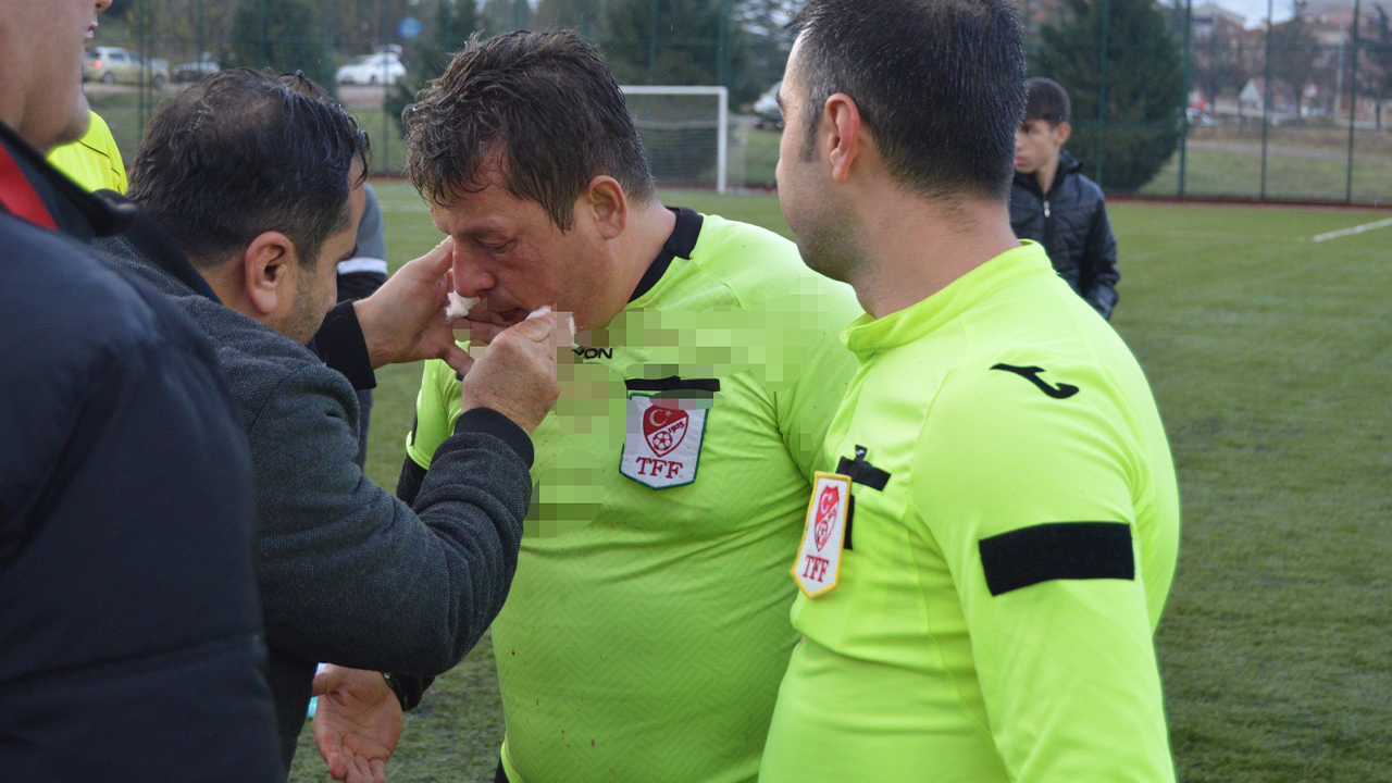 Hakeme Saldırı Anı Kameralara Yansıdı