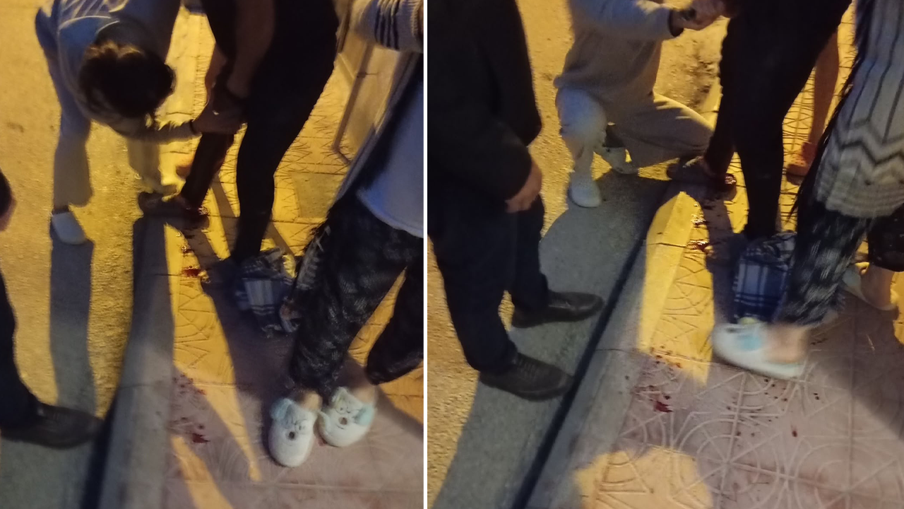 Saldırı Sonucu Bacağından Yaralandı